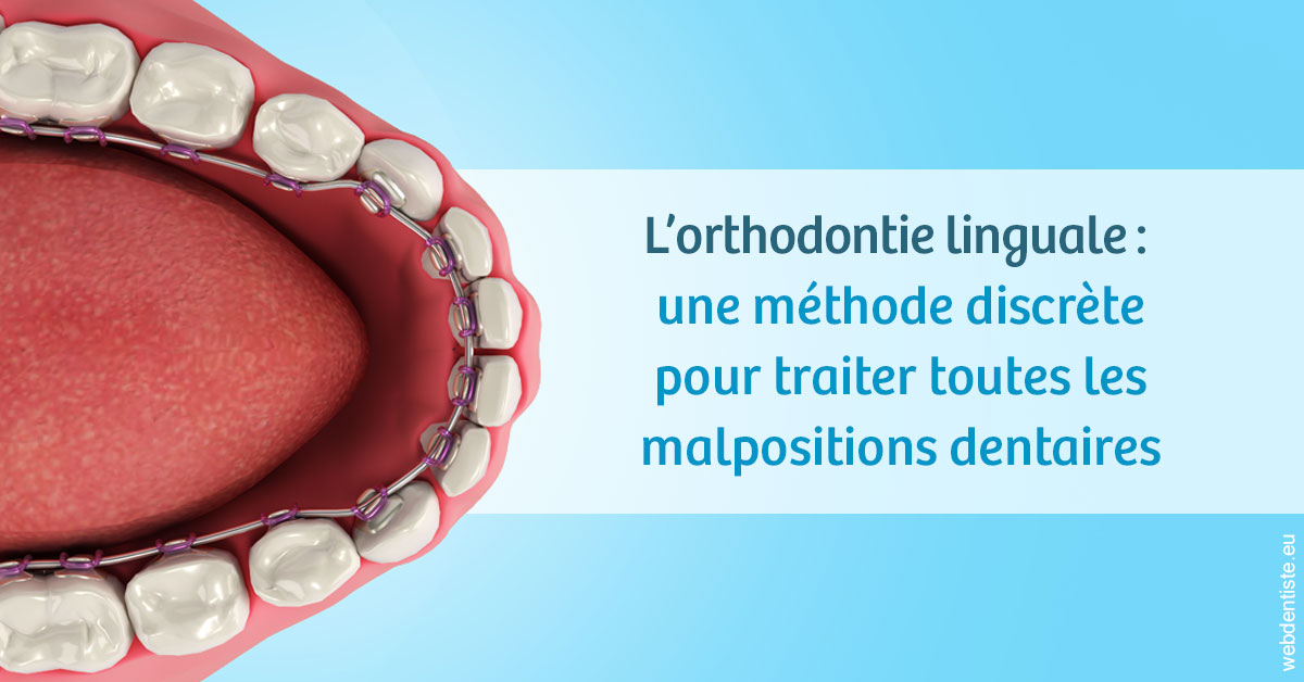 https://dr-ricci-anne-marie.chirurgiens-dentistes.fr/L'orthodontie linguale 1