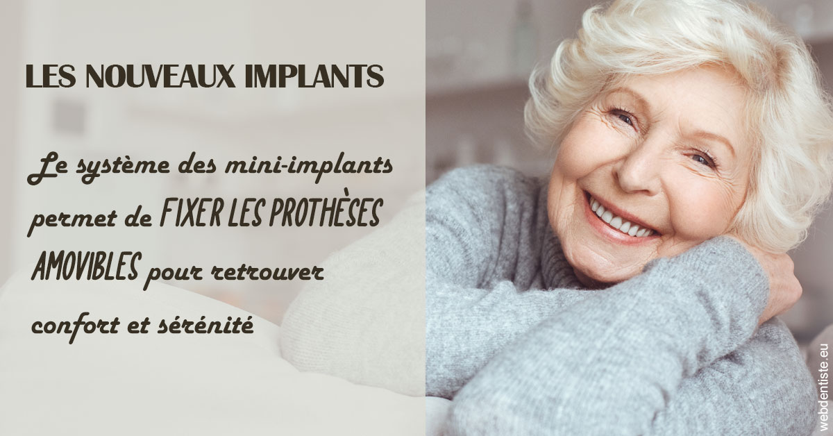 https://dr-ricci-anne-marie.chirurgiens-dentistes.fr/Les nouveaux implants 1