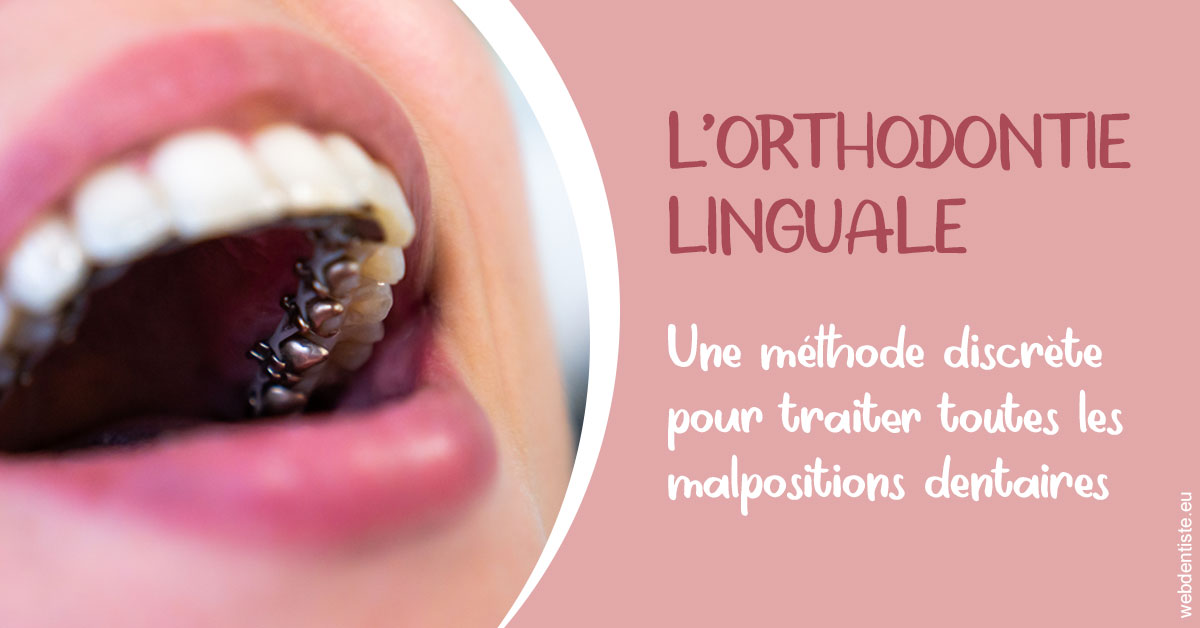 https://dr-ricci-anne-marie.chirurgiens-dentistes.fr/L'orthodontie linguale 2
