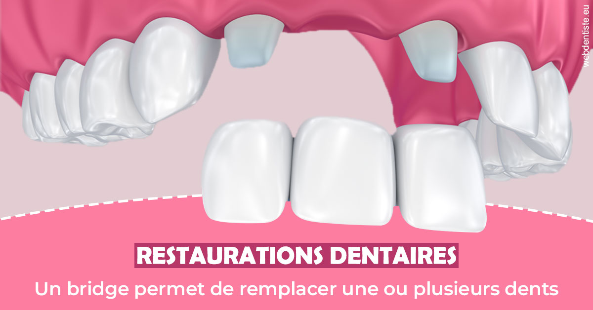https://dr-ricci-anne-marie.chirurgiens-dentistes.fr/Bridge remplacer dents 2