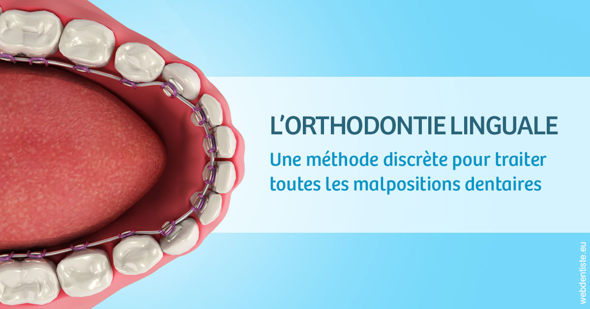 https://dr-ricci-anne-marie.chirurgiens-dentistes.fr/L'orthodontie linguale 1