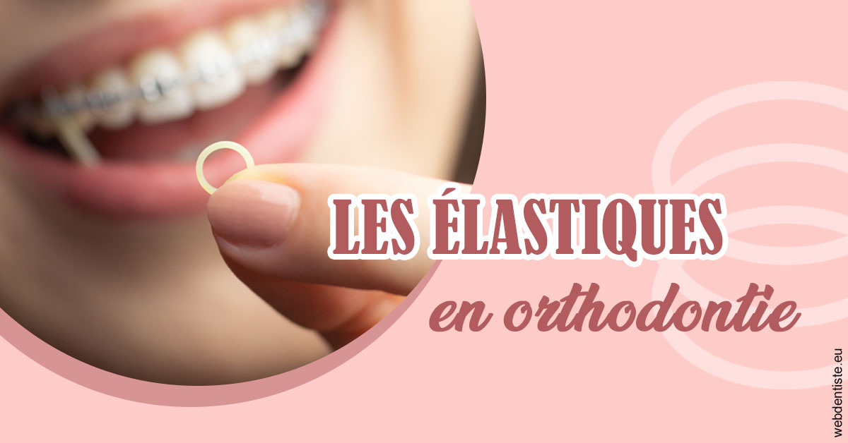 https://dr-ricci-anne-marie.chirurgiens-dentistes.fr/Elastiques orthodontie 1