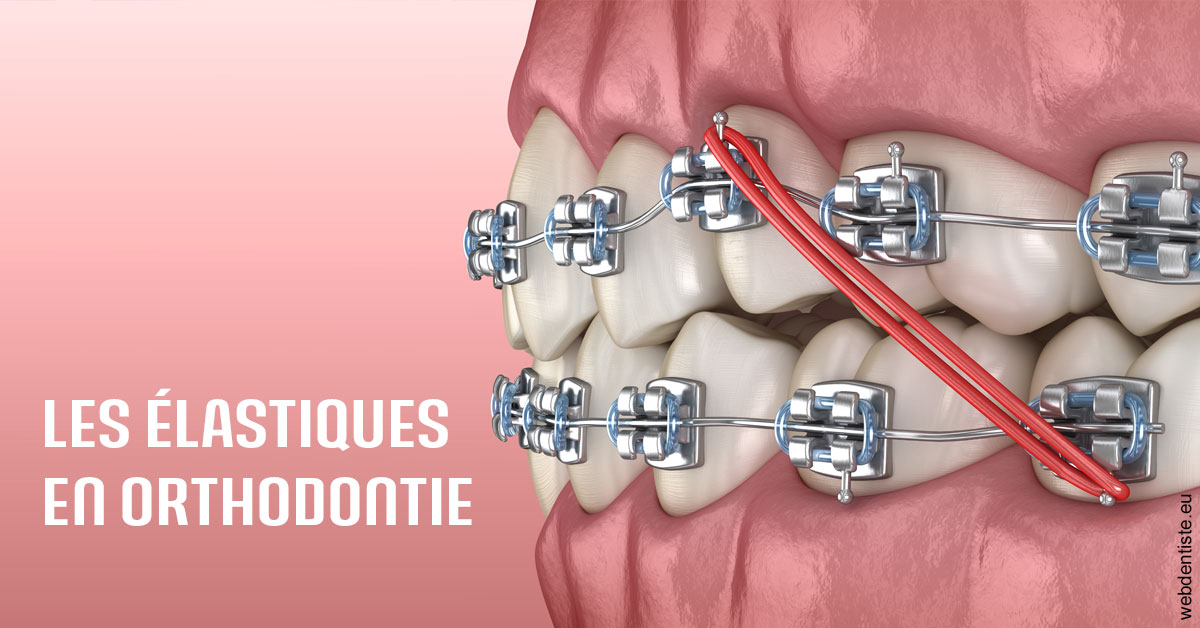 https://dr-ricci-anne-marie.chirurgiens-dentistes.fr/Elastiques orthodontie 2
