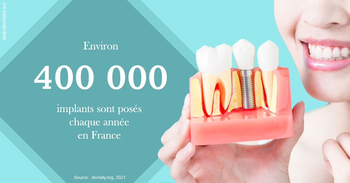 https://dr-ricci-anne-marie.chirurgiens-dentistes.fr/Pose d'implants en France 2